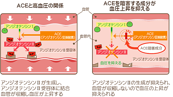 ACEと高血圧の関係