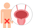 がんの抑制 膀胱の発がんを抑制する