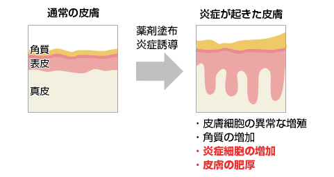 皮膚の炎症